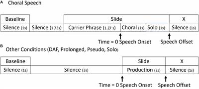 The Effects of Fluency Enhancing Conditions on Sensorimotor Control of Speech in Typically Fluent Speakers: An EEG Mu Rhythm Study